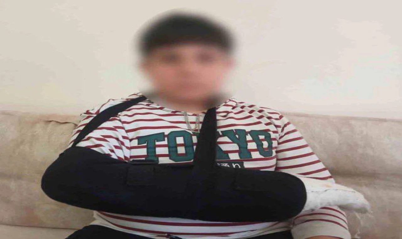 Okulda kavga sonucu 12 yaşındaki öğrencinin parmağı kırıldı