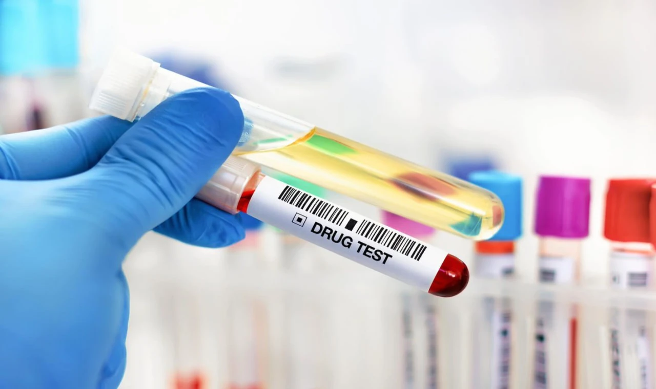 İş Başvurularında Uyuşturucu Testi Talebi Yükselişte