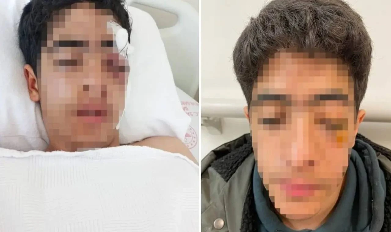 Esenyurtta Akran Şiddeti 15 Yaşındaki Çocuk Ağır Yaralandı!
