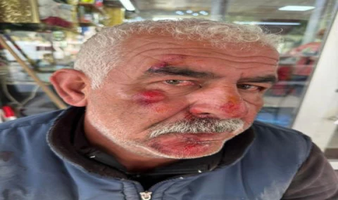 Manisa’da Köpek Dehşeti!