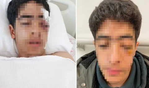 Esenyurtta Akran Şiddeti 15 Yaşındaki Çocuk Ağır Yaralandı!